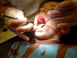 Tìm hiểu về sâu răng sữa và việc bảo vệ sức khỏe của trẻ